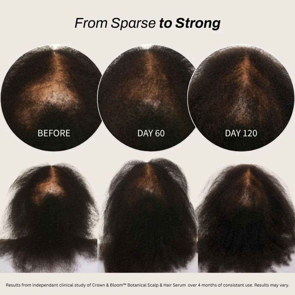 Sérum botánico para cuero cabelludo y cabello Crown & Bloom™