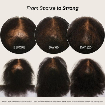 Sérum botánico para cuero cabelludo y cabello Crown & Bloom™